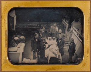Verwendung von Äther zur Anästhesie von Albert Sands Southworth